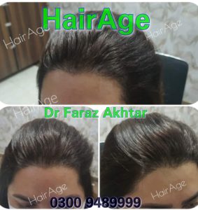 Female Before and After