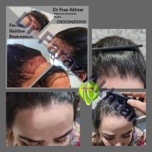 Female Before and After