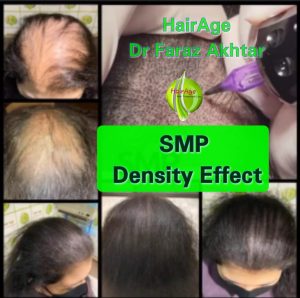 Female Before and After